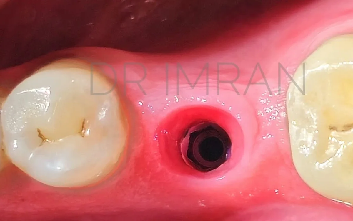 Restorative dentistry and smile care